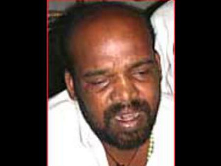 ನರಳುತ್ತಲೇ ಈ ಲೋಕಕ್ಕೆ ವಿದಾಯ ಹೇಳಿದ ನೀಗ್ರೋ ಜಾನಿ!