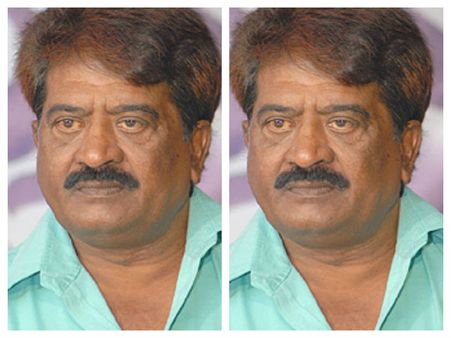 ಗ್ಯಾಂಗ್ರಿನ್ ನಿಂದ ಕಾಲು ಕಳೆದುಕೊಂಡ ಹಿರಿಯ ನಟ ಸತ್ಯಜಿತ್