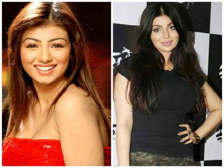 ಪ್ಲಾಸ್ಟಿಕ್ ಸರ್ಜರಿ ತಂದ ಎಡವಟ್ಟು: ಹೆಂಗಿದ್ದ ನಟಿ ಹೆಂಗಾಗಿದ್ದಾರೆ ನೋಡಿ.!