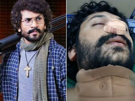 ಚಿತ್ರೀಕರಣ ವೇಳೆ ಅವಘಡ: ನಟ ಭುವನ್ ಮುಖಕ್ಕೆ ಗಾಯ