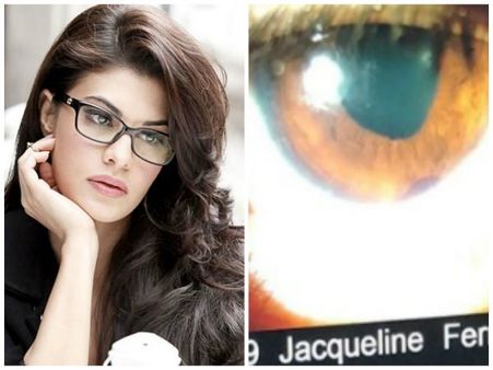 ಸಾಹಸ ಮಾಡಲು ಹೋದ ನಟಿ ಜಾಕ್ವೆಲಿನ್ ಕಣ್ಣಿಗೆ ಶಾಶ್ವತ ಗಾಯ.!