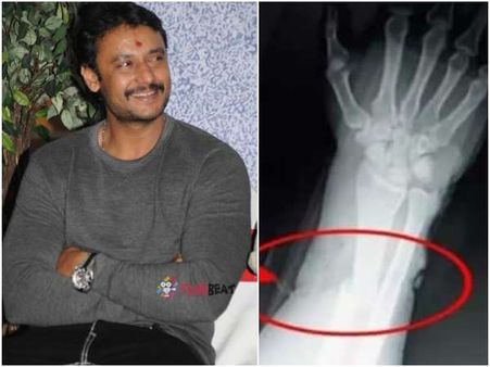 ದರ್ಶನ್ ಸ್ಥಿತಿ ಈಗ ಹೇಗಿದೆ?: ಆಸ್ಪತ್ರೆಯಿಂದ ಇಂದು ಡಿಸ್ಚಾರ್ಜ್ ಆಗಲ್ಲ