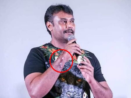 'ಆರದ ಗಾಯ'ದಲ್ಲೇ ಶೂಟಿಂಗ್ ಗೆ ಹೊರಟ್ರಾ.? ದರ್ಶನ್ ಕೈ ಈಗ ಹೇಗಿದೆ.?