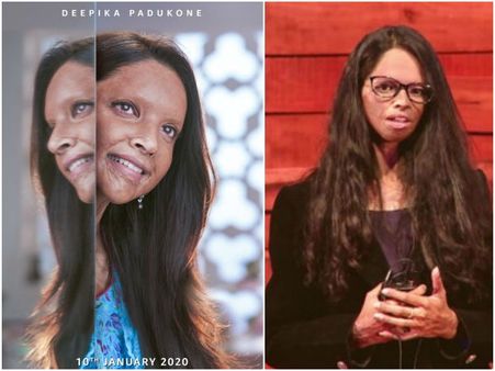 'ಚಪಾಕ್' ಸಿನಿಮಾದ ಫಸ್ಟ್ ಲುಕ್ ನಲ್ಲಿ ದೀಪಿಕಾ