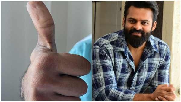 ಅಪಘಾತದ ಬಳಿಕ ಮೊದಲ ಪೋಸ್ಟ್ ಶೇರ್ ಮಾಡಿದ ನಟ ಸಾಯಿ ಧರಮ್ ತೇಜ್: ಆರೋಗ್ಯ ಸ್ಥಿತಿ ಹೇಗಿದೆ?