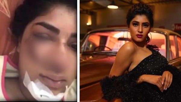 ರಿಯಾಲಿಟಿ ಶೋ ಸ್ಪರ್ಧಿ ದಿವ್ಯಾ ಸುರೇಶ್‌ಗೆ ರಸ್ತೆ ಅಪಘಾತ!