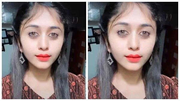 ಸೊಂಟ ದಪ್ಪಾ ಆಗಿದೆ ಎಂದು ಫ್ಯಾಟ್ ಸರ್ಜರಿಗೆ ಮುಂದಾಗಿದ್ದ ಚೇತನಾ!