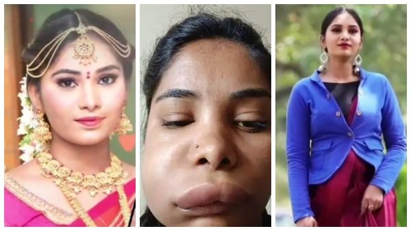 ಸ್ಯಾಂಡಲ್‌ವುಡ್ ನಟಿಯ ಪಾಲಿಗೆ ವಿಲನ್ ಆದ ದಂತ ವೈದ್ಯೆ