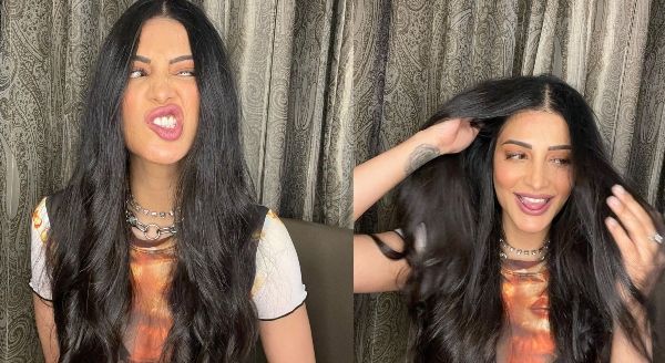 ನಟಿ ಶ್ರುತಿ ಹಾಸನ್‌ಗೆ ಆರೋಗ್ಯ ಸಮಸ್ಯೆ: ಬಹಿರಂಗ ಪೋಸ್ಟ್ ಹಂಚಿಕೊಂಡ ನಟಿ!