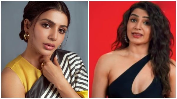 ಸಮಂತಾ ಮುಖಕ್ಕೆ ಪ್ಲಾಸ್ಟಿಕ್ ಸರ್ಜರಿ? ಫೋಟೊಗಳು ಫುಲ್ ವೈರಲ್