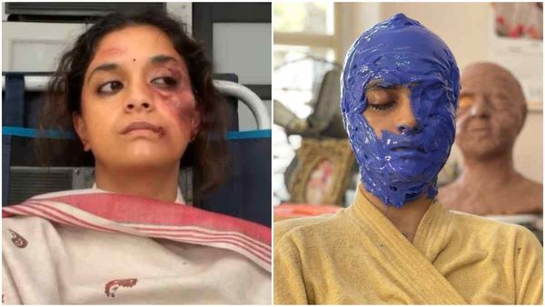 ಅಯ್ಯೋ ಮಹಾನಟಿಗೆ ಏನಾಯ್ತು? ಕೀರ್ತಿ ಸುರೇಶ್ ಇನ್‌ಸ್ಟಾಗ್ರಾಮ್ ಪೋಸ್ಟ್‌ ಫುಲ್ ವೈರಲ್