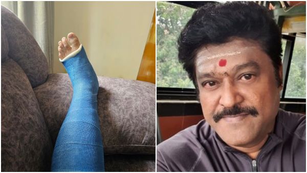 Jaggesh: ನವರಸನಾಯಕನ ಪಾದದ ಮೂಳೆ ಮುರಿತ.. 6 ವಾರ ನಡಿಗೆಗೆ ದಿಗ್ಬಂಧನ!