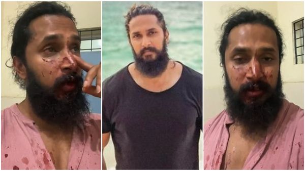 ನಟ ಚೇತನ್ ಚಂದ್ರ ಮೇಲೆ ಅಪರಿಚಿತ ವ್ಯಕ್ತಿಗಳಿಂದ ಹಲ್ಲೆ; ರಕ್ತ ಸೋರುತ್ತಿದ್ದರು ಇನ್‌ಸ್ಟಾ ಲೈವ್‌