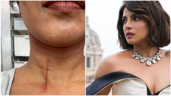 ಅಷ್ಟರಲ್ಲೇ ಜಸ್ಟ್ ಮಿಸ್, ಚಿತ್ರದ ಚಿತ್ರೀಕರಣ ವೇಳೆ ಪ್ರಿಯಾಂಕ ಕುತ್ತಿಗೆಗೆ ಗಾಯ..!