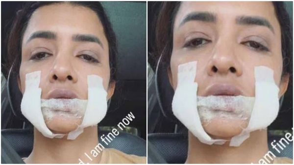 ಖ್ಯಾತ ನಟಿಯ ಮುಖಕ್ಕೆ ಏನಾಯ್ತು? ಜ್ವರಕ್ಕೆ ಮಾತ್ರೆ ತೆಗೆದುಕೊಳ್ಳುವ ಮುನ್ನ ಎಚ್ಚರ.. ಎಚ್ಚರ