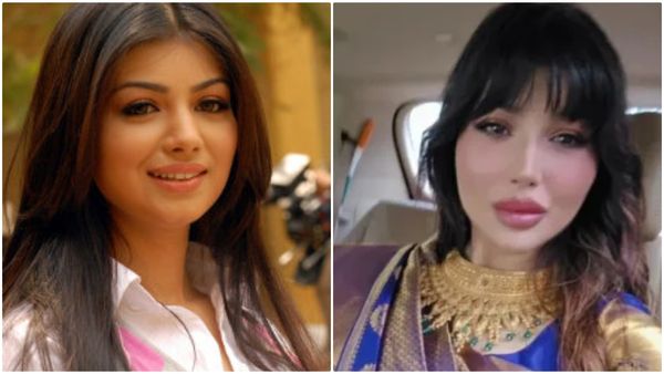 ಬಿಂದಾಸ್ ಬೆಡಗಿ ಆಯೇಶಾ ಟಾಕಿಯಾ ಮುಖಕ್ಕೆ ಏನಾಯ್ತು? ಬೇಸರದಿಂದ ಆಕೆ ಮಾಡಿದ್ದೇನು?