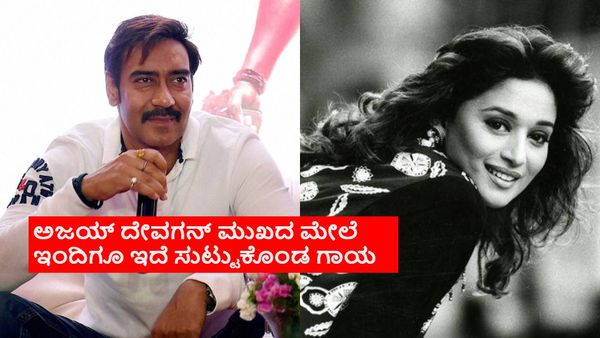 ಮಾಧುರಿ ಬ್ಯೂಟಿಗೆ ಹುಚ್ಚನಾಗಿದ್ದ ಅಜಯ್ ದೇವಗನ್ ಸಿಗರೇಟ್‌ನಿಂದ ಮುಖ ಸುಟ್ಟುಕೊಂಡಿದ್ದ? ಇನ್ನೂ ಇದೆ ಆ ಗುರುತು!