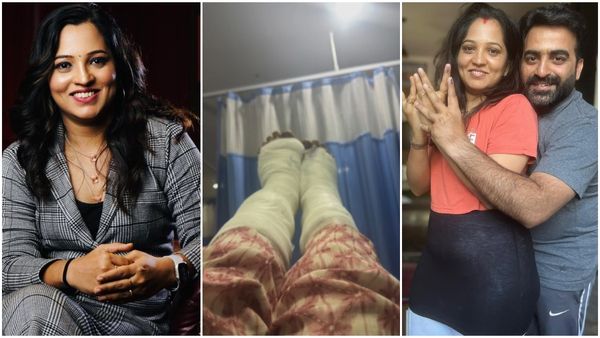 ಮಾಸ್ಟರ್ ಆನಂದ್ ಪತ್ನಿಯ ಕಾಲಿಗೆ ಏನಾಯ್ತು ? 2 ಕಾಲಿಗೆ ಬ್ಯಾಂಡೇಜ್ ನೋಡಿ ಫ್ಯಾನ್ಸ್ ಶಾಕ್..!