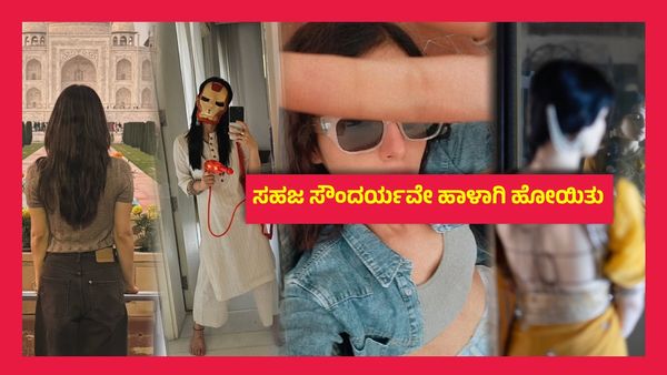 ಪ್ಲಾಸ್ಟಿಕ್ ಸರ್ಜರಿ ಮಾಡಿಸಿಕೊಂಡ ಮತ್ತೊಬ್ಬ ಖ್ಯಾತ ನಟಿ, ಗುರುತು ಹಿಡಿಯದ ಫ್ಯಾನ್ಸ್..!