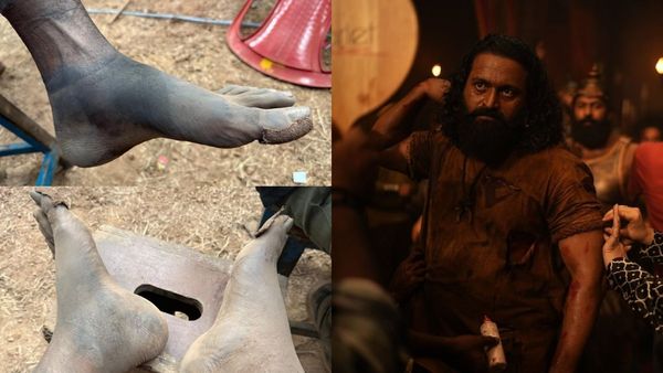 'ಕಾಂತಾರ- 1' ಕ್ಲೈಮ್ಯಾಕ್ಸ್ ಶೂಟ್ ನೋವಿನ ಕಥೆ ಬಿಚ್ಚಿಟ್ಟ ರಿಷಬ್ ಶೆಟ್ಟಿ