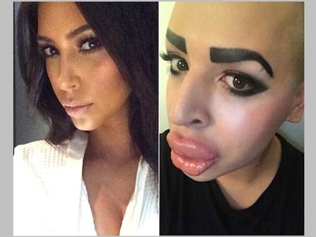 ആരാധന മൂത്തു, സ്വന്തം മുഖവും മാറ്റി