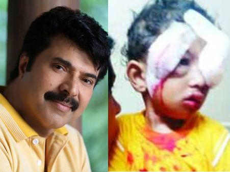 പിറന്നാള്‍ ദിനത്തില്‍ മമ്മൂട്ടിയെത്തി; തെരുവനായ കടിച്ച കുട്ടിയ്ക്ക് സഹായവുമായി