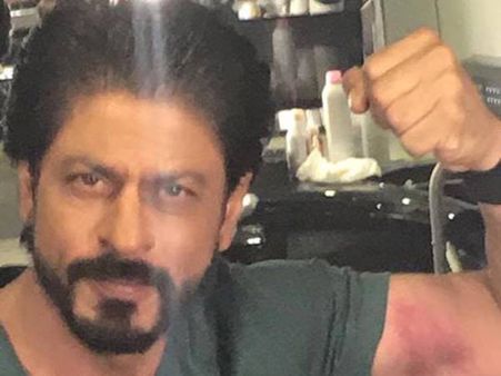 ദില്‍വാലെയുടെ സെറ്റില്‍ വച്ച് ഷാരൂഖിന് പരിക്ക്