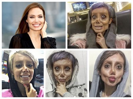 ഹോട്ട് നടിയെ പോലെയാവാന്‍ 50 ശാസ്ത്രക്രിയ, പത്തൊമ്പതുകാരിയുടെ ഭീകര രൂപമാറ്റം കണ്ട് ലോകം തന്നെ ഞെട്ടി