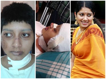 നടി അനുമോള്‍ക്ക് ഇതെന്ത് പറ്റി.. വൈറലാവുന്ന ചിത്രങ്ങളുടെ സത്യം വേദനയോടെ നടി തന്നെ വെളിപ്പെടുത്തി!
