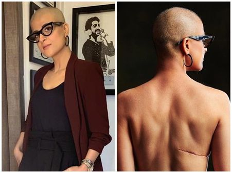 എന്റെ ദിവസമാണ്!! കാൻസർ ശസ്ത്രക്രിയയുടെ പാടുകൾ പങ്കുവെച്ച് താരപത്നി, കാണൂ