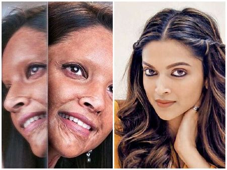 ഇത് ദീപിക തന്നെയാണോ!! മുഖത്ത് ആസിഡ് വീണ പാടുമായി താരം, ഛാപാക്കിലെ ലുക്ക് പുറത്ത്..