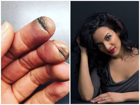 ഈ മുറിവുകൾ എനിക്കൊരു വേദനയല്ല!! ഇത് കണ്ട് നിങ്ങൾ വിഷമിക്കേണ്ട, വിരലിലെ മുറിവുകളെ കുറിച്ച് അനൗഷ്ക