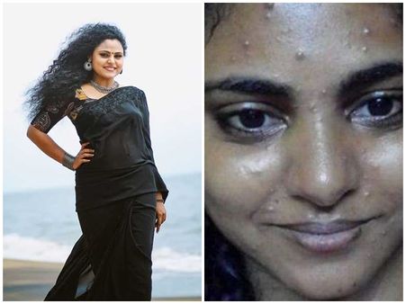 വിൻസിയുടെ മുഖം കണ്ട് ഞെട്ടണ്ട!! ജീവിതത്തിൽ വഴിത്തിരിവായ ചിത്രം പങ്കുവെച്ച് താരം...