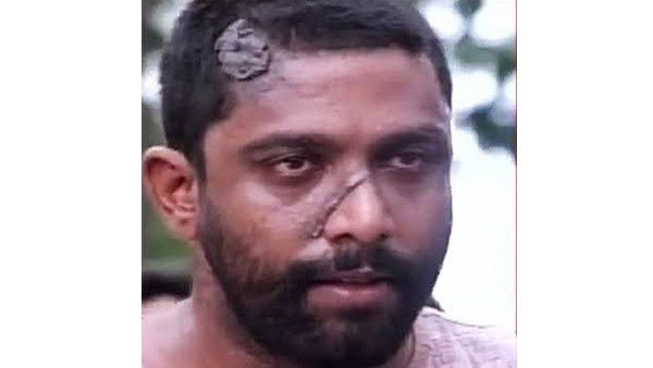 കീരിക്കാടന്‍ ജോസ് ആശുപത്രിയിൽ; സത്യം ഇതാണ്, വെളിപ്പെടുത്തി ബന്ധു