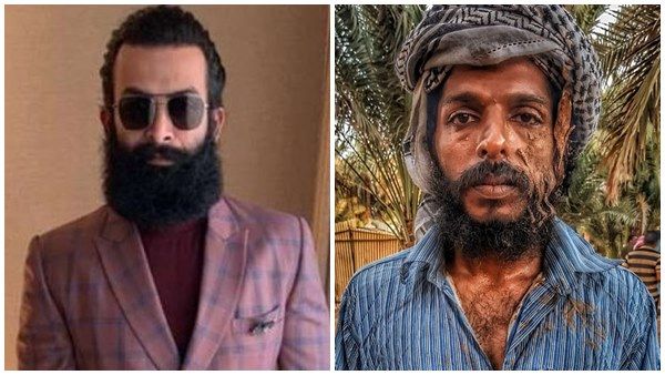 പൃഥിയുടെ കഷ്ടപ്പാടുകളോര്‍ത്ത് ദൈവത്തെ വിളിച്ച ഒരമ്മയുടെ വേദന മറ്റൊരമ്മക്ക് മനസ്സിലാകു, കുറിപ്പ് വൈറൽ
