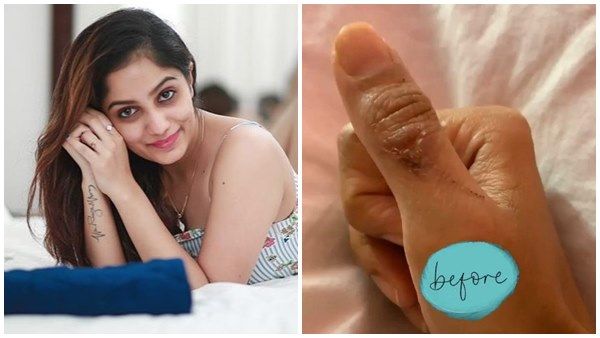 ആര്യയുടെ കൈയിലെ മുറിവിന്റെ പാട്! ബിഗ് ബോസില്‍ നിന്നും ഒരിക്കലും മറക്കാന്‍ പറ്റാത്തത് ഇതായിരിക്കും