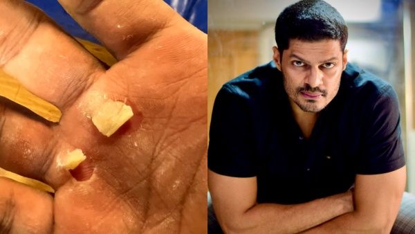 'പുതിയ അസുഖമോ വൈറസോ ആണോയെന്ന് സംശയം'; വിമാനത്തിലുണ്ടായ അനുഭവം പറ‍‍ഞ്ഞ് സുദേവ് നായർ!