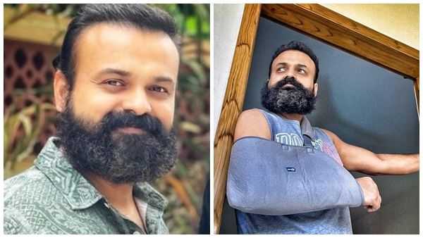 ആശാന്റെ കൈ തല്ലിയൊടിച്ചോ? പരുക്കന്‍ കഥാപാത്രം ഡിമാന്‍ഡ് ചെയ്ത പരിക്കാണെന്ന് നടന്‍ കുഞ്ചാക്കോ ബോബന്‍