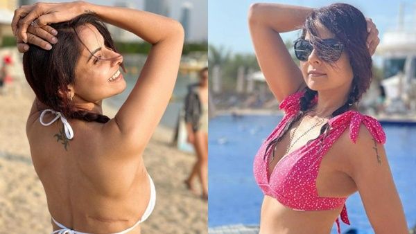 നിന്റെ സ്തനങ്ങള്‍ മുറിച്ച് മാറ്റിയില്ലേ? ശരിക്കും ക്യാന്‍സര്‍ ഉണ്ടായിരുന്നോ? മറുപടിയുമായി നടി