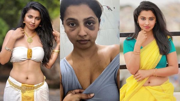 ഈ മുഖം വച്ച് നീയെങ്ങനെ അഭിനയിക്കും! കാമുകന്‍ ക്രൂരമായി പീഡിപ്പിച്ചു! വെളിപ്പെടുത്തി നടി അനിഖ