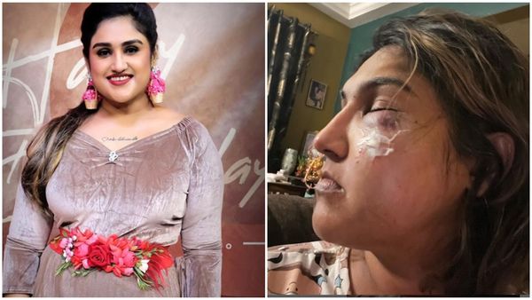 രാത്രി ഒരു മണിയ്ക്കാണ് സംഭവം, അയാള്‍ എന്നെ ക്രൂരമായി ആക്രമിച്ചു! ഫോട്ടോ സഹിതം തെളിവ് പുറത്ത് വിട്ട് നടി വനിത