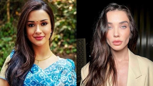 സംസാരിക്കുമ്പോൾ നെറ്റി പോലും ചുളിയുന്നില്ല; മുഖത്ത് എമി ജാക്സൺ വരുത്തിയ മാറ്റങ്ങൾ; ഫില്ലറും ബോട്ടോക്സും?