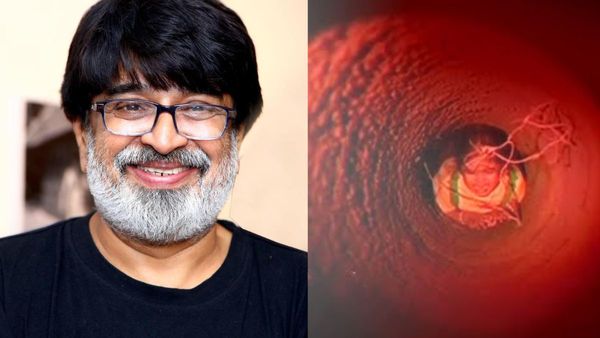 കുട്ടിയെ കുഴിയില്‍ ചാടിച്ചതില്‍ പേടിയുണ്ടായിരുന്നു, ഇന്ന് നടക്കില്ല, മാളൂട്ടിയെ കുറിച്ച് വേണു