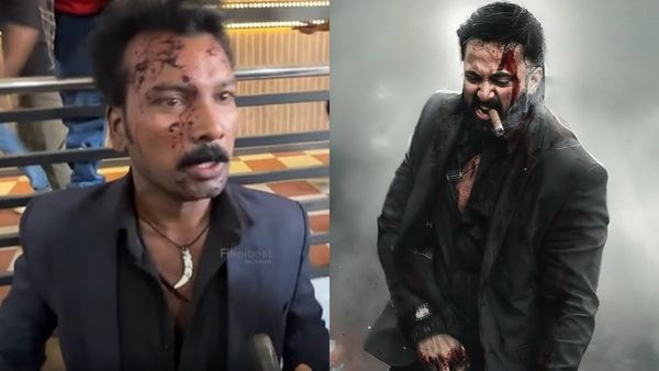 മാര്‍ക്കോ എന്താലായും അണ്ണന്റെ മൂട്ടില്‍ മാര്‍ക്ക് വീണിട്ടുണ്ട്! മൂടും കുത്തി വീണ് എയറിലായി മാര്‍ക്കോ ഫാന്‍