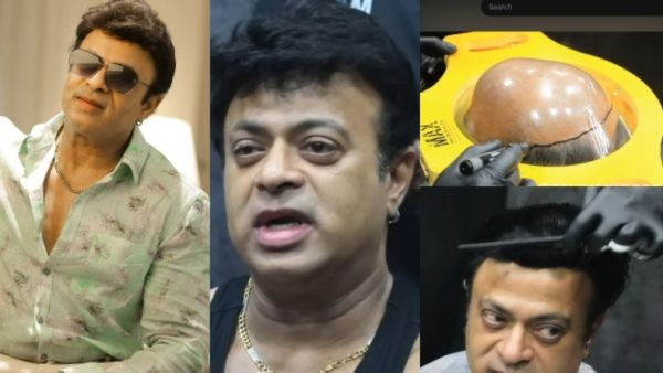 പല താരങ്ങൾക്കും ഇല്ലാത്ത ധൈര്യം...; വർഷങ്ങളായി കഷണ്ടിയുണ്ട്, മുടി തിരിച്ച് വരുമെന്ന് കരുതി ഷേവ് ചെയ്തു; റിയാസ്