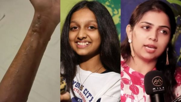 ഷൂട്ടിനിടയിൽ ശരീരത്തിലേക്ക് തീ അടിച്ചു, മോളുടെ കൈയ്യും കണ്ണും ചെവിയും പൊള്ളി; മകളുടെ അപകടത്തെ കുറിച്ച് അഞ്ജലി