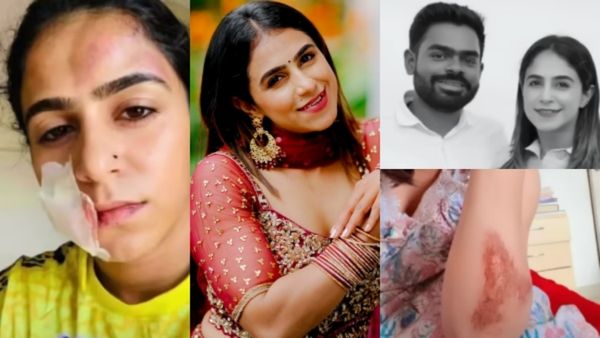 പ്രണയിച്ചതിന് കിട്ടിയ പ്രതിഫലം; മുഖത്തും ശരീരത്തും ആഴത്തിൽ മുറിവുകൾ, കാമുകന്റെ ക്രൂരമർദ്ദനത്തിന് ഇരയായി ജസീല!