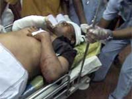 மதுரை அருகே கார் விபத்தில் சிக்கினார் நடிகர் ராமராஜன்