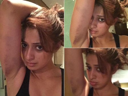 சண்டைக் காட்சியில் அடிபட்டேன்- பேஸ்புக்கில் ஸ்டேட்டஸ் போட்டு அனுதாபம் தேடிய ராய் லட்சுமி