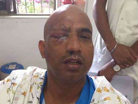 கார் மீது தாக்குதல்: நடிகர் காயம்- கண் பார்வை பறிபோகும் அபாயம்